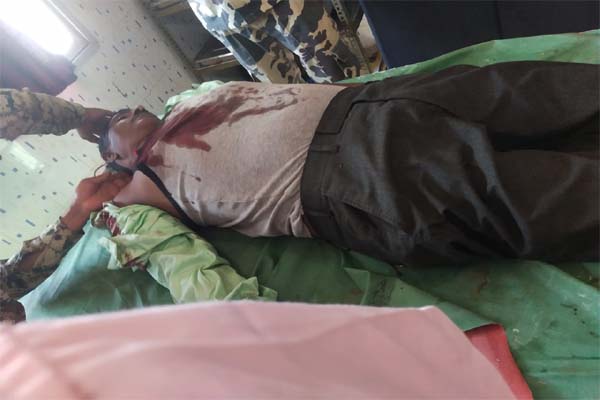 दुर्गूकोंदल में भाजपा नेता रमेश गावड़े की गोली मारकर हत्या