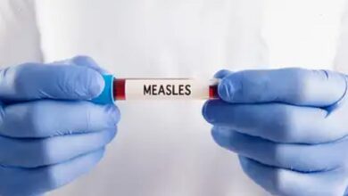 Bangladesh Measles Outbreak
