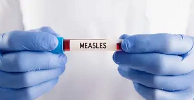 Bangladesh Measles Outbreak