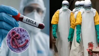 Ebola Virus