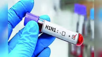 Swine Flu