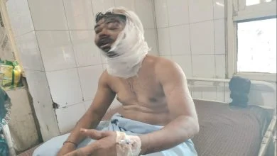 Girlfriend Attacked Boyfriend