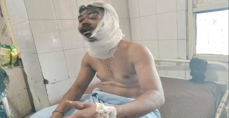Girlfriend Attacked Boyfriend